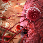 Ai cũng có tế bào ung thư trong cơ thể: 3 nguyên tắc vàng chặn đứng sự hình thành khối u