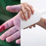 Nếu không may bị đứt tay thì đây chính xác là những gì bạn phải làm
