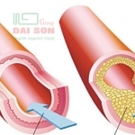 Có phải “bệnh khớp đớp tim”?