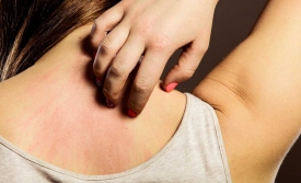 6 triệu chứng nhận biết làn da của bạn đang gặp vấn đề, cần quan tâm chăm sóc kỹ càng hơn