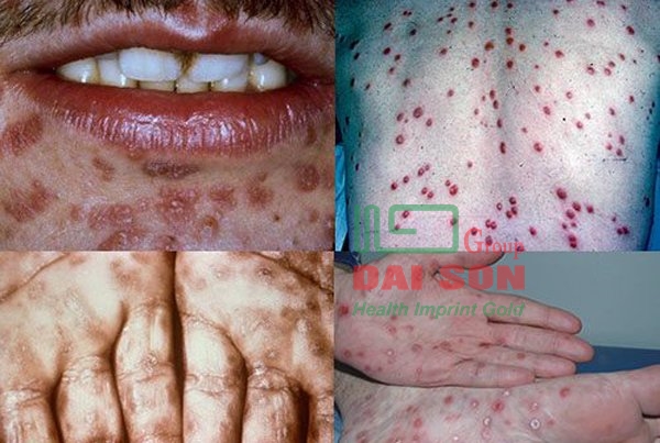 Show 'Hẹn hò và hôn': Giật mình hàng loạt bệnh sẽ lây khi hôn người lạ